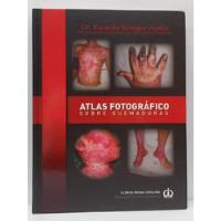 Libro Atlas Fotografico Sobre Quemaduras segunda mano  Colombia 